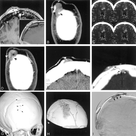 Fig 2.