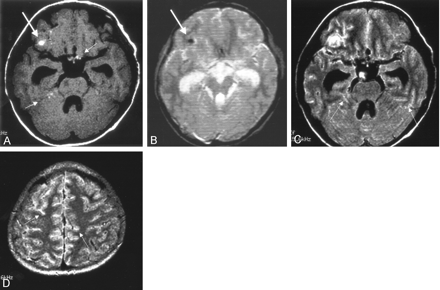 Fig 1.