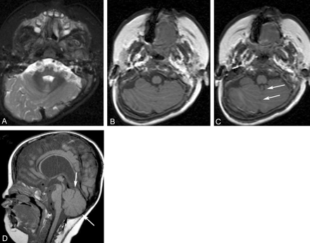 Fig 1.