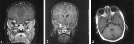 Fig 3.