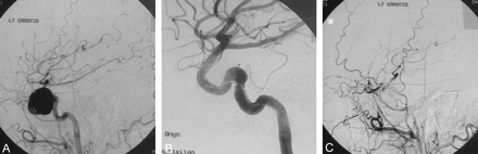 Fig 4.