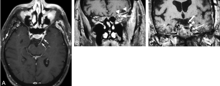 Fig 1.