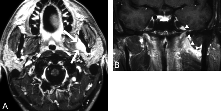 Fig 2.