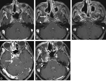 Fig 4.