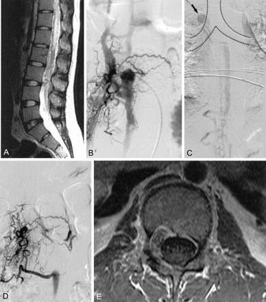 Fig 2.