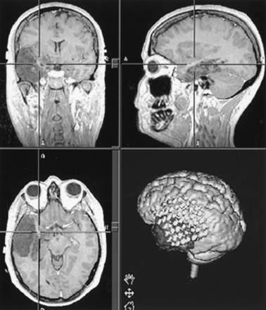 Fig 1.