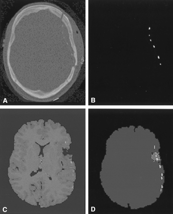 Fig 2.