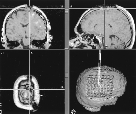 Fig 3.