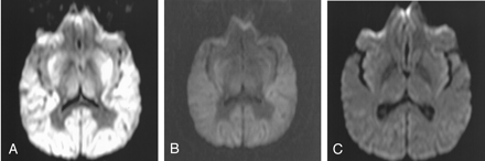 Fig 2.