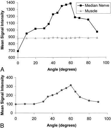 Fig 3.
