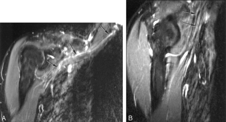 Fig 4.