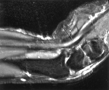Fig 6.