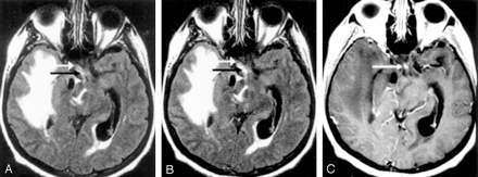 Fig 3.