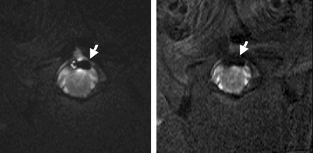 Fig 2.