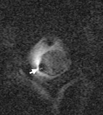 Fig 5.