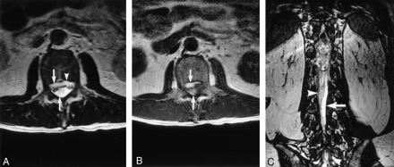 Fig 3.
