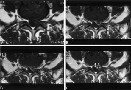 Fig 1.