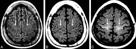 Fig 2.