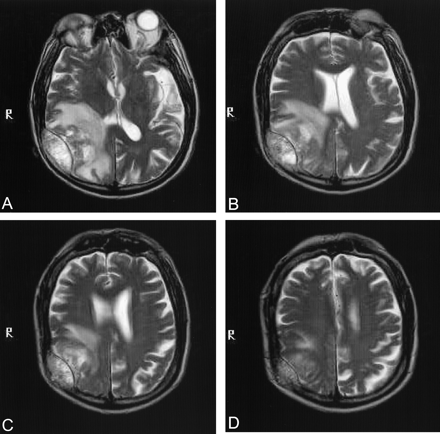 Fig 4.
