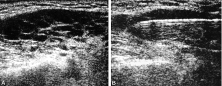 Fig 1.