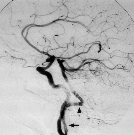 Fig 3.