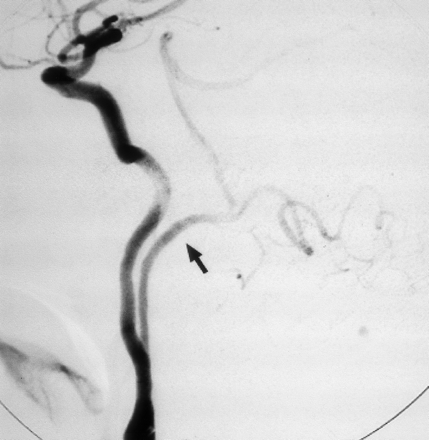 Fig 4.