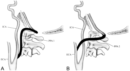 Fig 6.