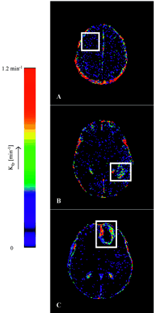 Fig 1.