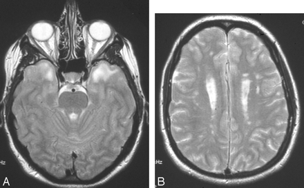 Fig 5.