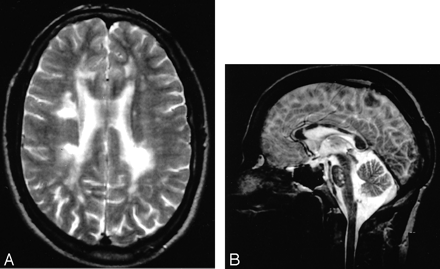 Fig 6.