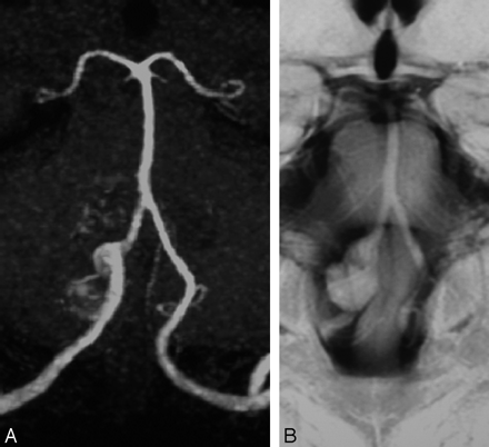 Fig 6.