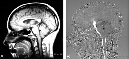 Fig 1.