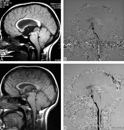 Fig 3.