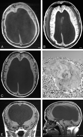 Fig 5.
