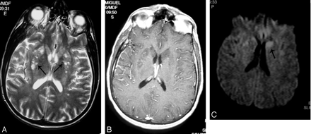 Fig 1.