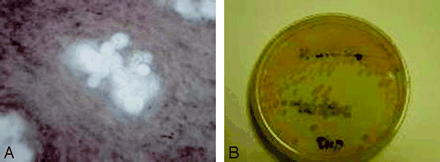 Fig 2.
