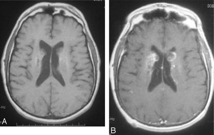 Fig 5.