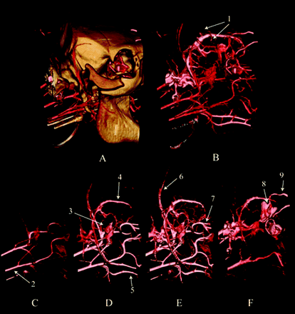 Fig 1.
