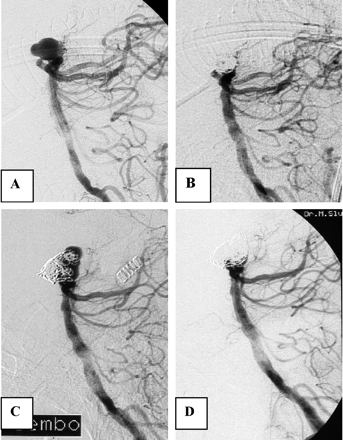 Fig 3.