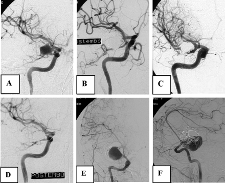 Fig 4.