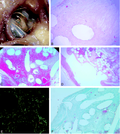 Fig 1.