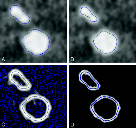 Fig 2.