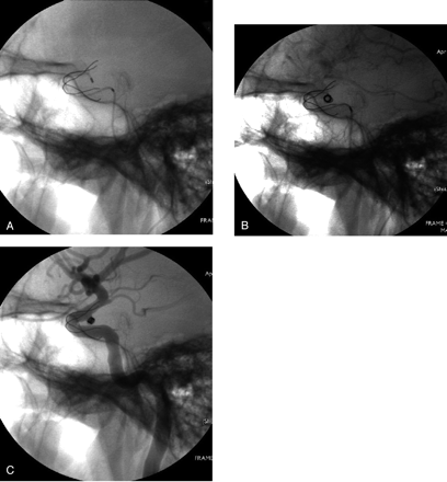 Fig 6.