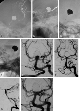 Fig 2.