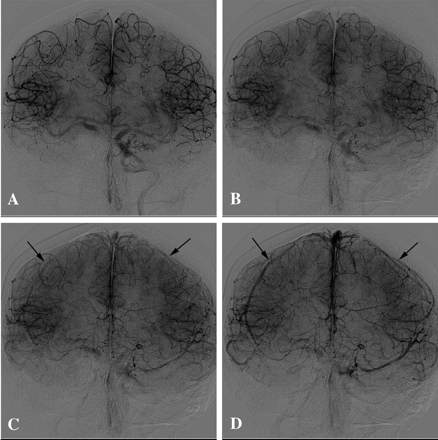 Fig 1.