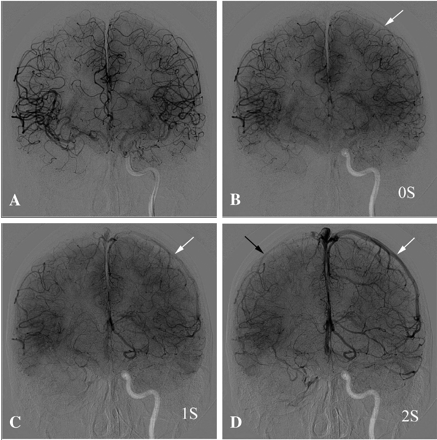 Fig 2.