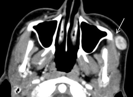 Fig 1.