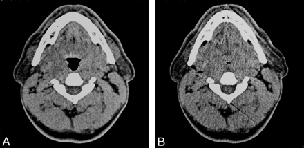 Fig 1.