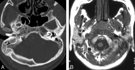 Fig 3.