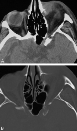 Fig 1.